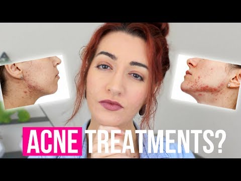 ACNE TREATMENTS - WHAT WORKED & WHAT SUCKED! Commenting On your Comments! | Jess Bunty