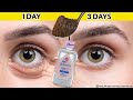 How To Get Rid of Eye Bags &amp; Dark Circles in 3 Days | Remove Under Eye Bags and wrinkles Completely