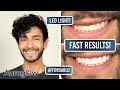 Whiter Teeth in JUST A WEEK! | NEW AuraGlow Teeth Whitening Updated Kit