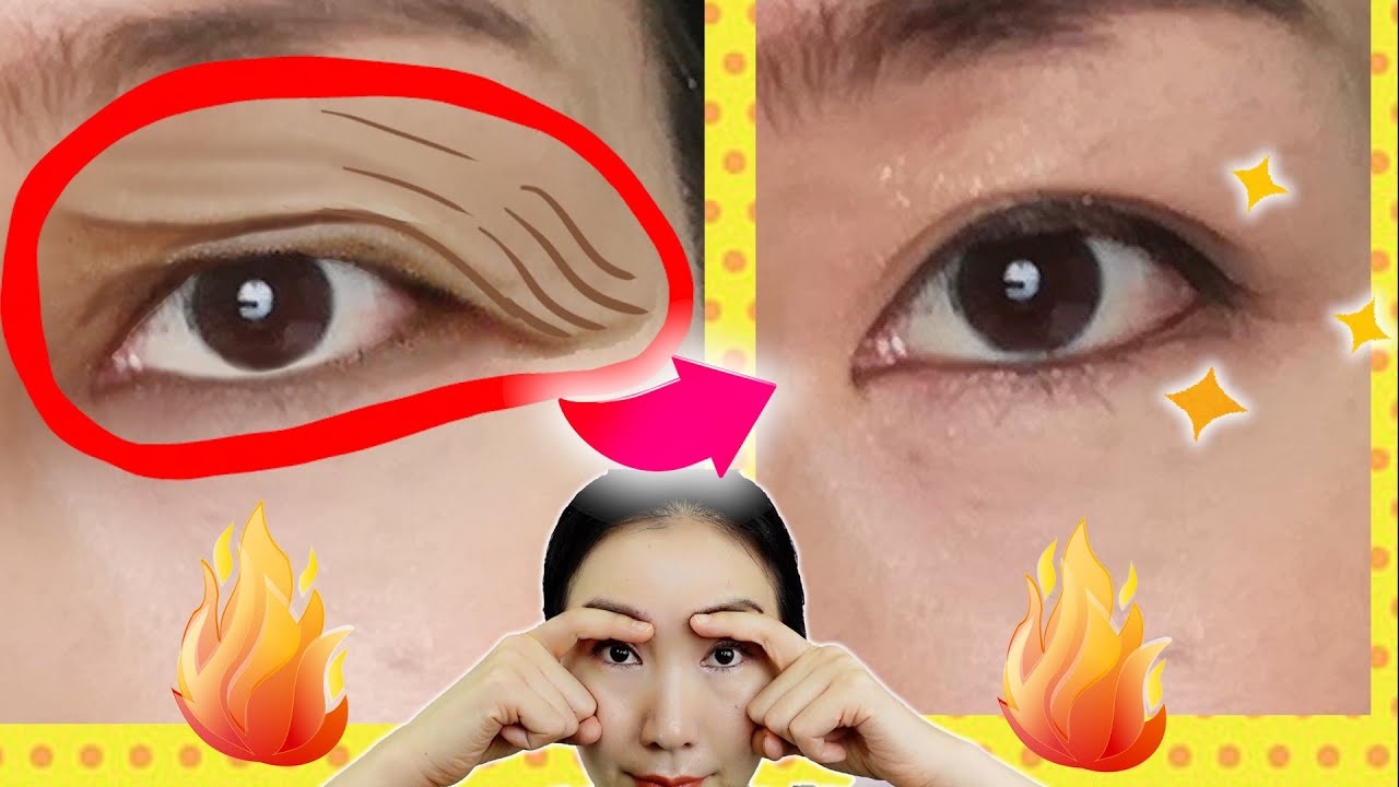 Magic Shiatsu Massage    Intense Exercises to Tighten Droopy Eyelids in 7 Days