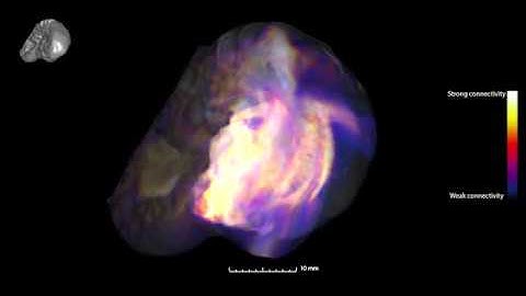 Virtual Fetus - Mapping the development of the human brain