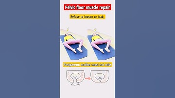 Postpartum Pelvic Floor Muscle Repair Exercises For Women #shorts