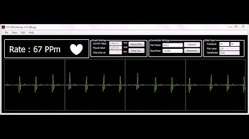 Computer - AVR Based ECG