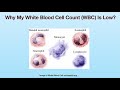 Why My White Blood Cell Count WBC Is Low Why My White Blood Cell Count WBC Is Low