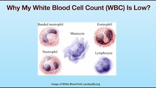 Why My White Blood Cell Count (WBC) Is Low?