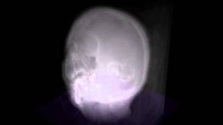 3D scanner of a human head