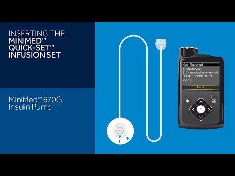 Inserting the Quick-set Infusion Set with the MiniMed 670G Insulin Pump