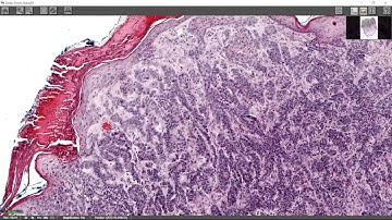 Fast, Automated Scanning