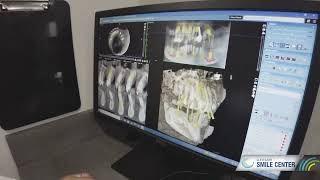 Cleveland Smile Center Uses Intraoral Scanning for more Accurate Results