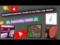 Dangerous diseases caused by bacteria and virus||most important topic |GK questions and answers