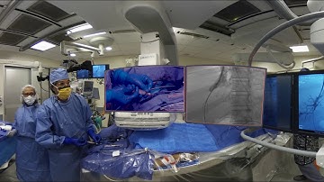 TIPS Part 9 JVIR VR /Haskal