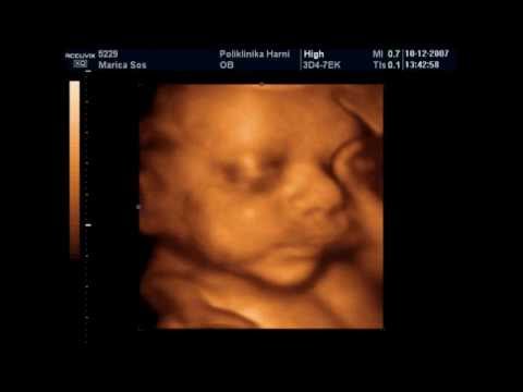 Video: 29 Tjedana Trudnoće - što Se Događa? Razvoj Fetusa, Senzacije