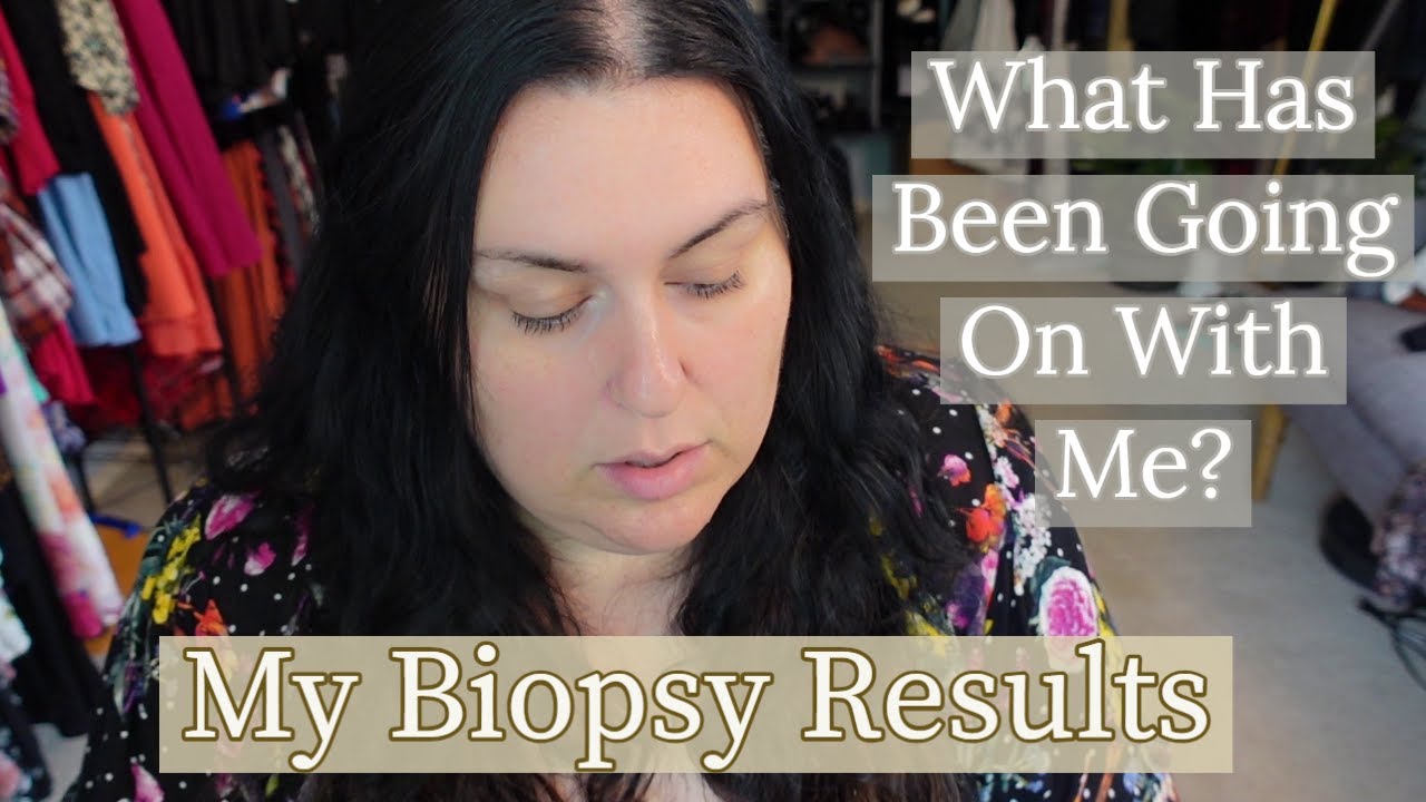 My Biopsy Results What Has Been Going On With Me Let S Talk Youtube