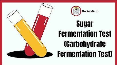Carbohydrate (Sugar) Fermentation Test | Biochemical Test | Microbiology Laboratory Techniques