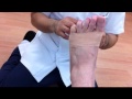 内反小趾のKINESIOTAPING　2011年8月6日