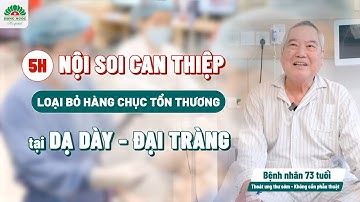 Nội soi can thiệp loại bỏ hàng chục tổn thương tại dạ dày - đại tràng