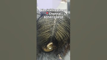Nits lice treatment in chennai just 2 hrs #headliceremoval#hair#licetreatment#lice#nitsliceremoval#