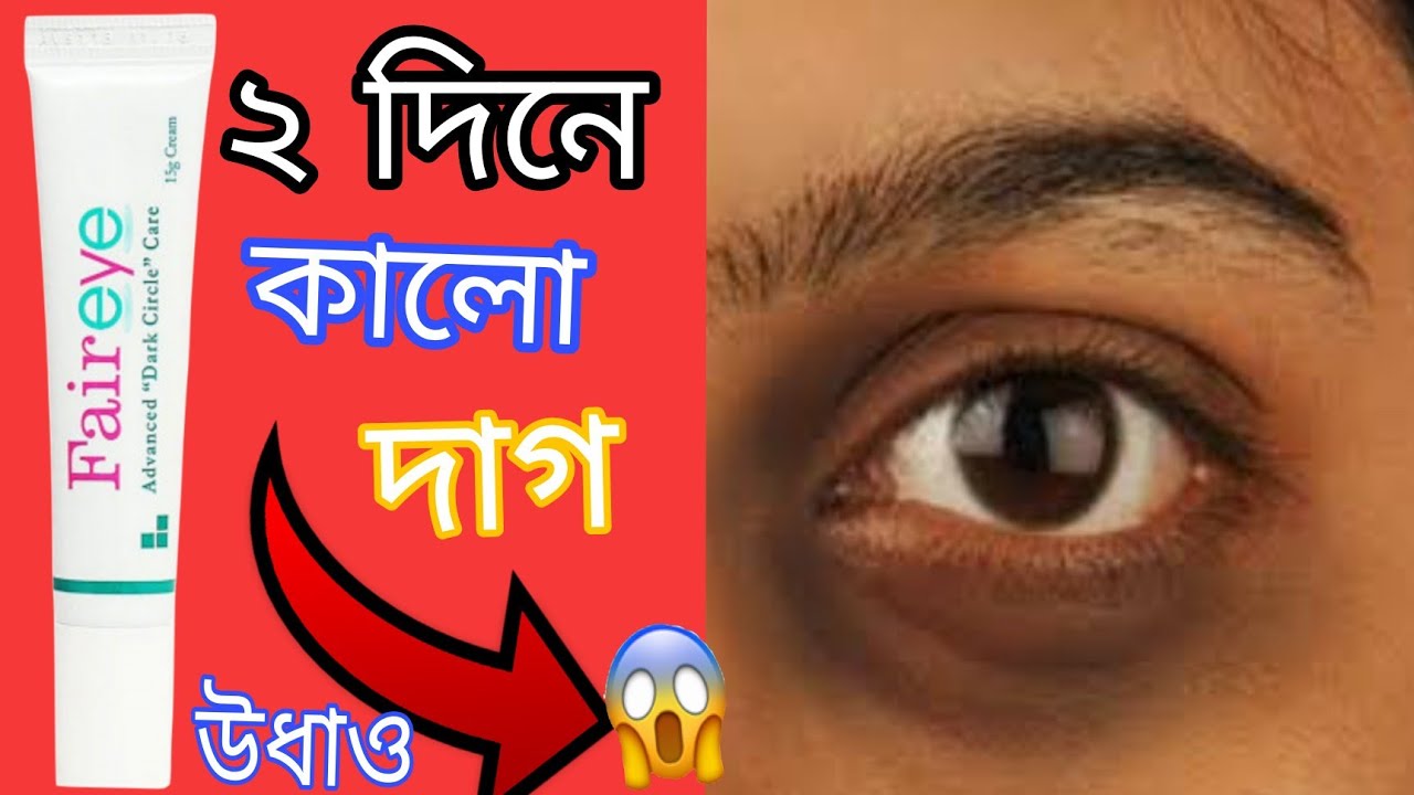 Fair eye cream How to remove dark circles চোখের নিচের কালো দাগ দূর