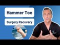 How Long Is Recovery From Hammer Toe Surgery?