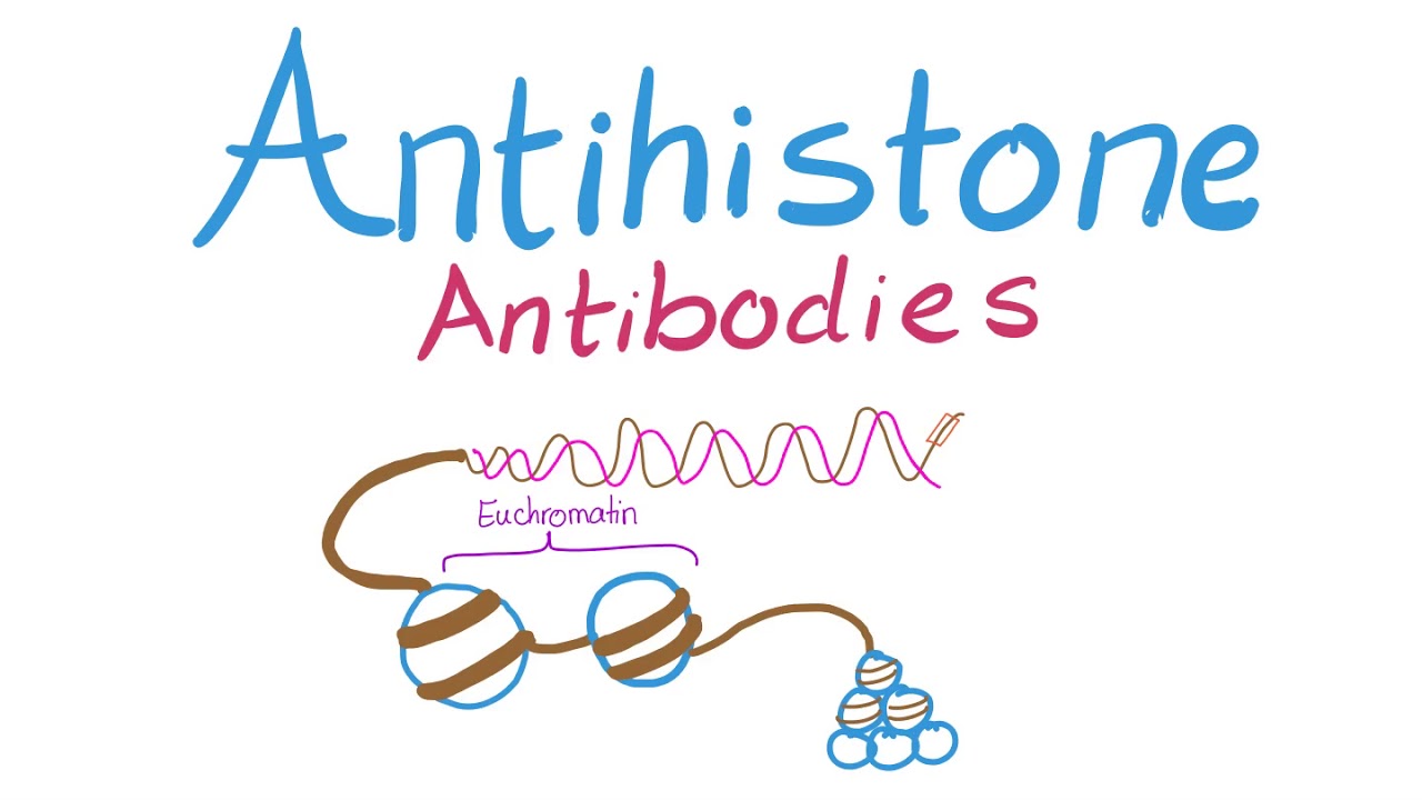 Antihistone Antibodies DrugInduced Lupus YouTube