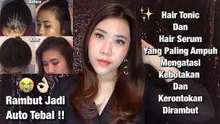 Produk Paling Ampuh Untuk Mengatasi Rambut Botak Dan Rontok Parah | Green Angelica Hair Care Review