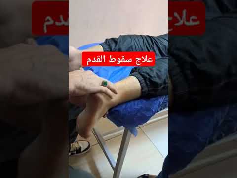 علاج سقوط القدم  اكسبلور دويتو  ترند لايك تيك توك   متابعه