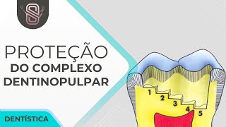 Proteção do Complexo Dentinopulpar - Dentística