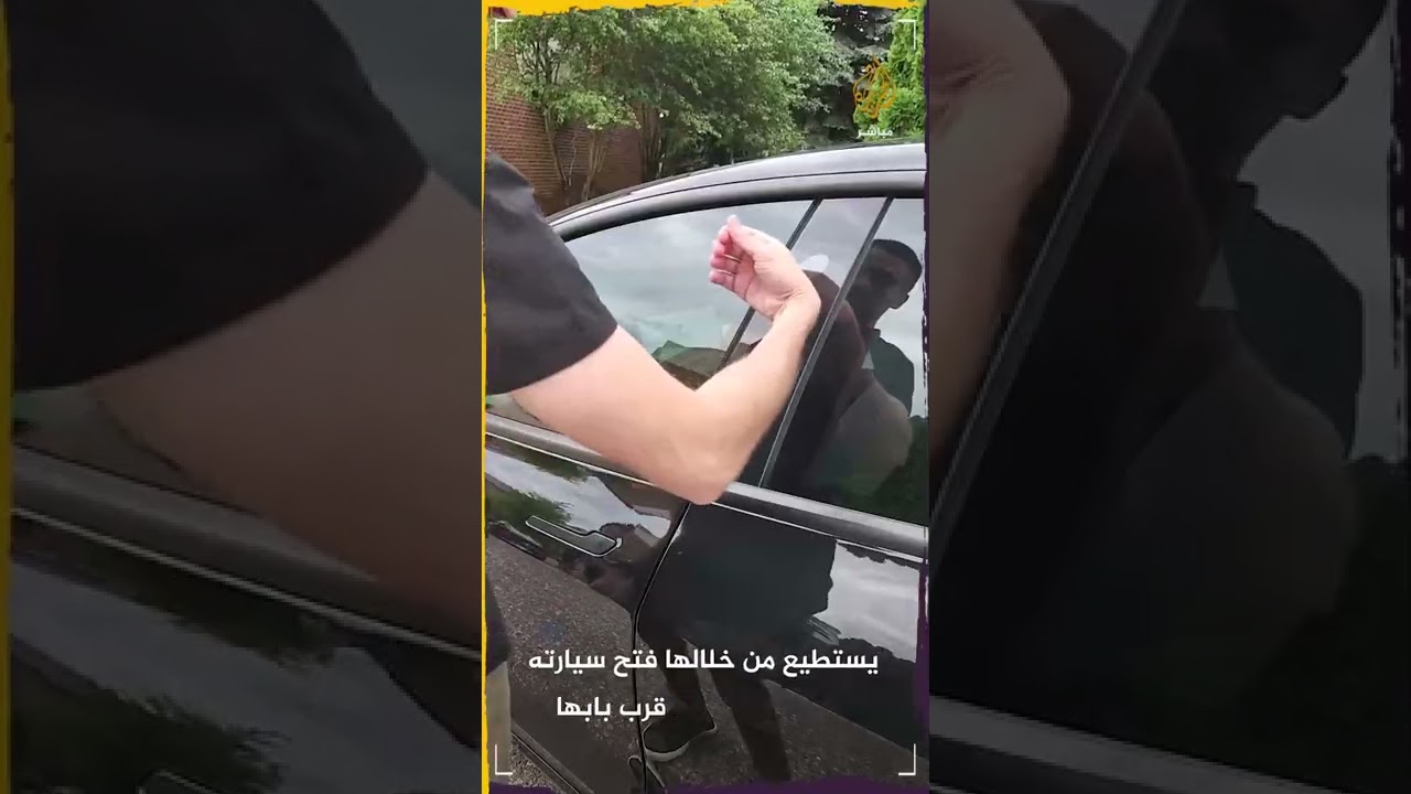 هل توافق على وضع شريحة إلكترونية تحت جلدك؟