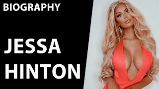 Jessa Hinton: Fashion Model, Social Media Sensation, And More | Biography And Net Worth