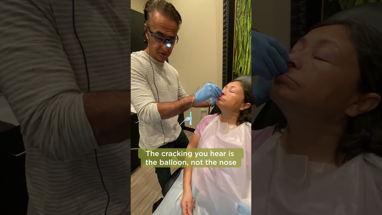 NASAL BALLOON INFLATION Balloon Septoplasty Part 6 