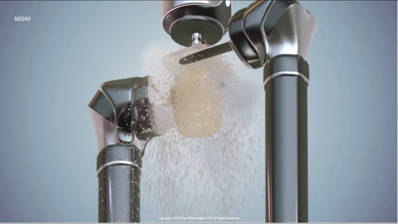 CAD-CAM Zirconia crown - YouTube