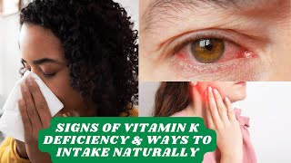 5 Signs Your Body Needs Vitamin K and Easy Natural Ways to Boost Your Health