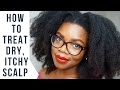 Pt.2 How To Use Aloe Vera on Natural Hair To Get Rid of Dry & Itchy Scalp