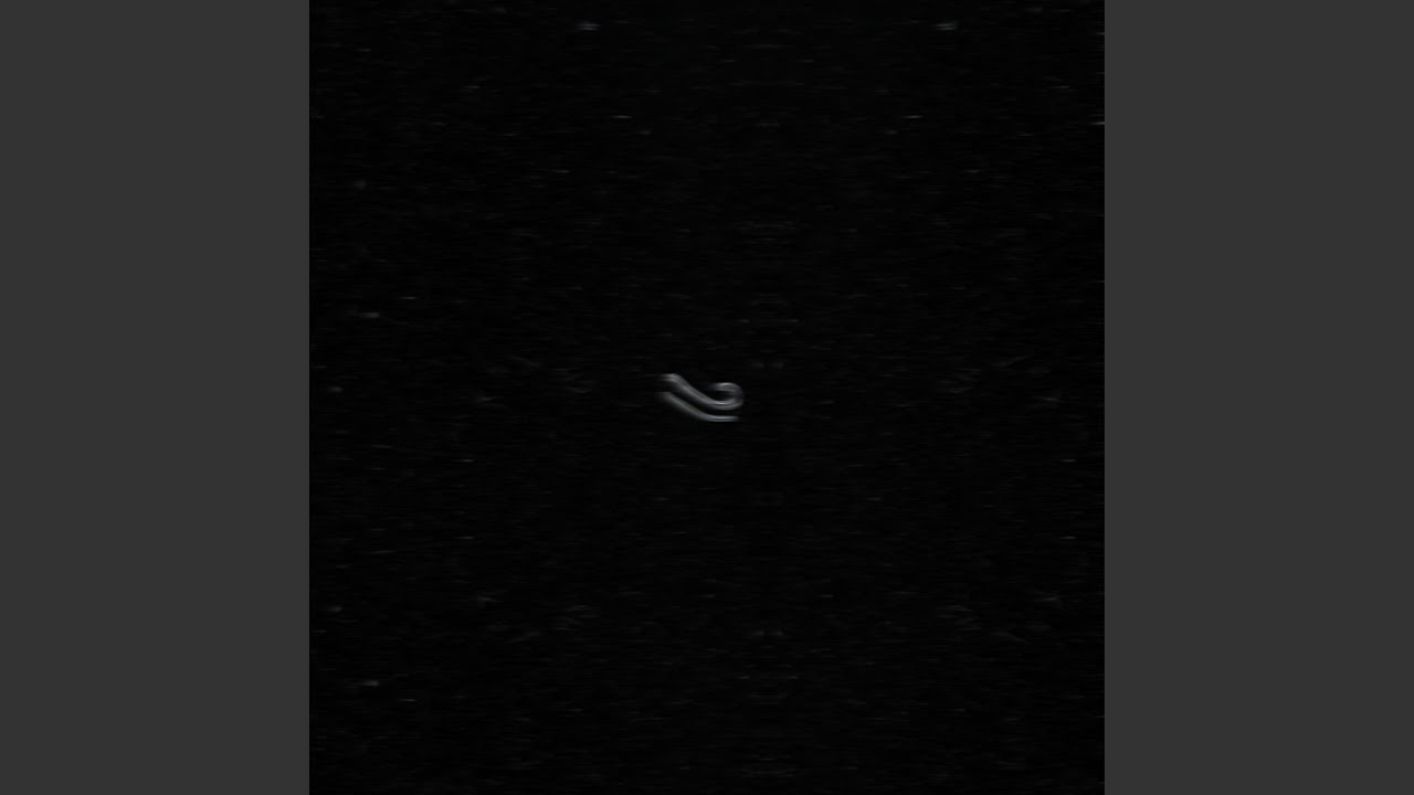 Παρακολούθηση OVERFLOW στο YouTube Παρακολούθηση OVERFLOW στο YouTube