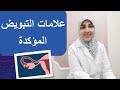 علامات التبويض  (أعراض حدوث الإباضة)