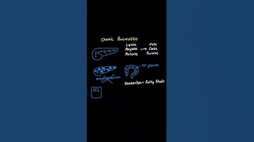 D446 OA – Het ene concept dat u moet begrijpen