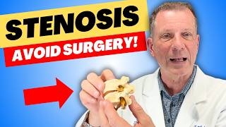 Spinal Stenosis? 5 Questions Everyone Asks Before Surgery