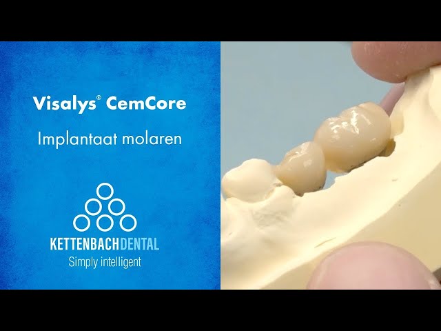 Visalys® CemCore als cementeercomposiet bij Implantologie