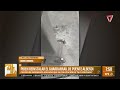TRAGEDIA EN LA RUTA | Alerta por el guardarrail del Puente Alberdi tras un choque fatal