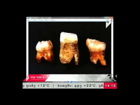 \"ჩვენი საგანძური\" 11.03.17  არქეოლოგიური აღმოჩენები ზემო იმერეთში