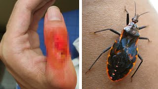 10 Dangerous Animals You Should Never Touch!