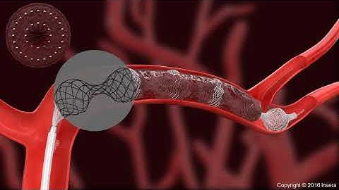 E-LEARNING MEDICAL SCIENCE VIDEO | 3D ANIMATION | EFFE CONSULTANCY