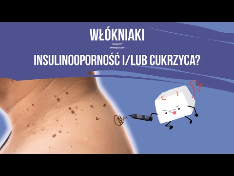 Zmiany skórne, które mogą oznaczać insulinooporność. Jak je rozpoznać i co warto wiedzieć.