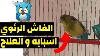 الفاش الرئوي : اسبابه_اعراضه _طرق العلاج