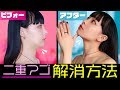 【ダイエット】いつでも出来る二重アゴ解消方法【二重アゴ痩せ2019】