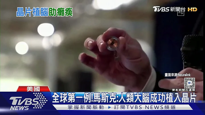 全球首例!馬斯克X平台宣布 人類大腦成功植入晶片｜TVBS新聞 @TVBSNEWS01 - 天天要聞