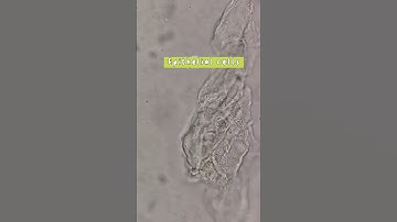 urine sediments under the microscope #laboratory #medtechstudent #mls #cls #medtech #urinalysis #mlt