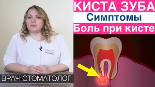 Киста зуба - симптомы, самодиагностика, боль при кисте зуба. Правильная диагностика кисты зуба.