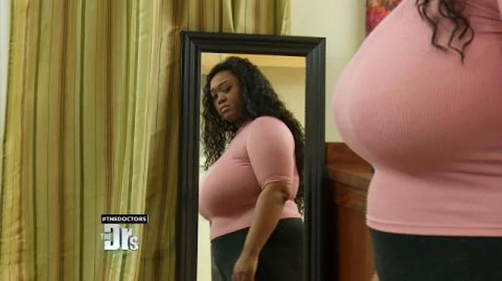 19-Year-Old Struggles with Size K Breasts
