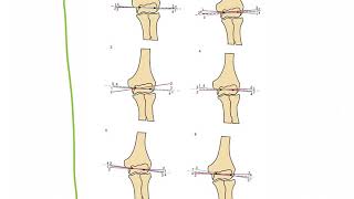 Celebrity Elbow Joint Axis of Motion   ELBOW COMPLEX Profile